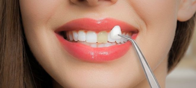 dental care