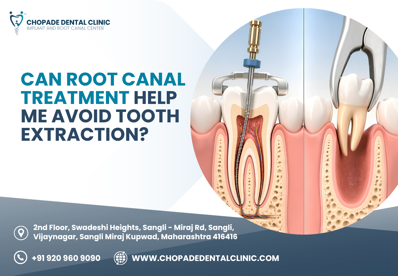 root canal treatment cost