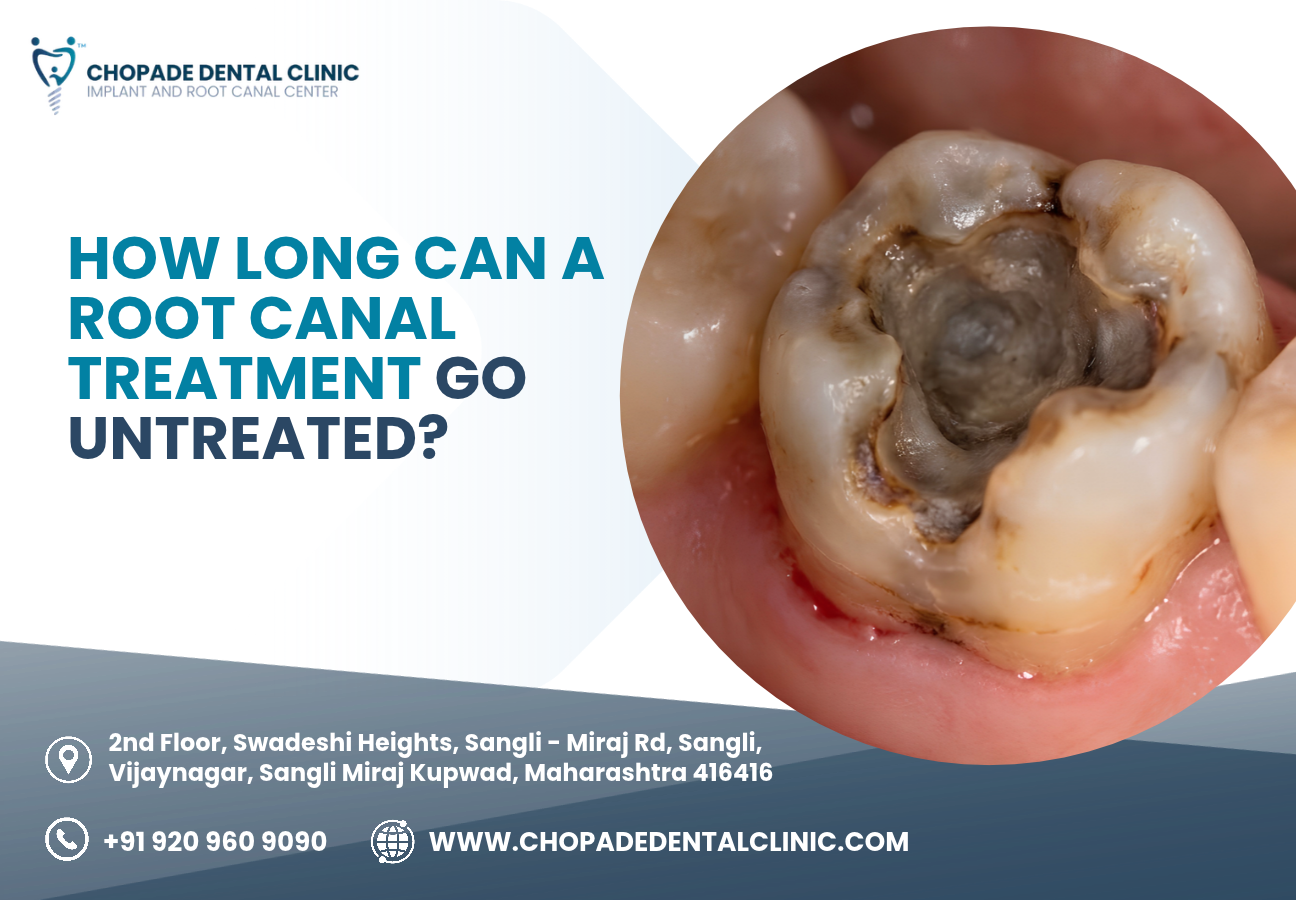 root canal treatment  near me