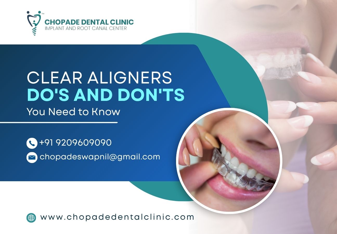 Clear Aligners Do's and Don'ts You Need to Know