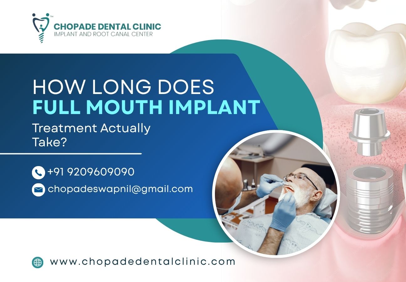 How Long Does Full Mouth Implant Treatment Actually Take?
